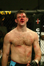 Forrest Griffin 1